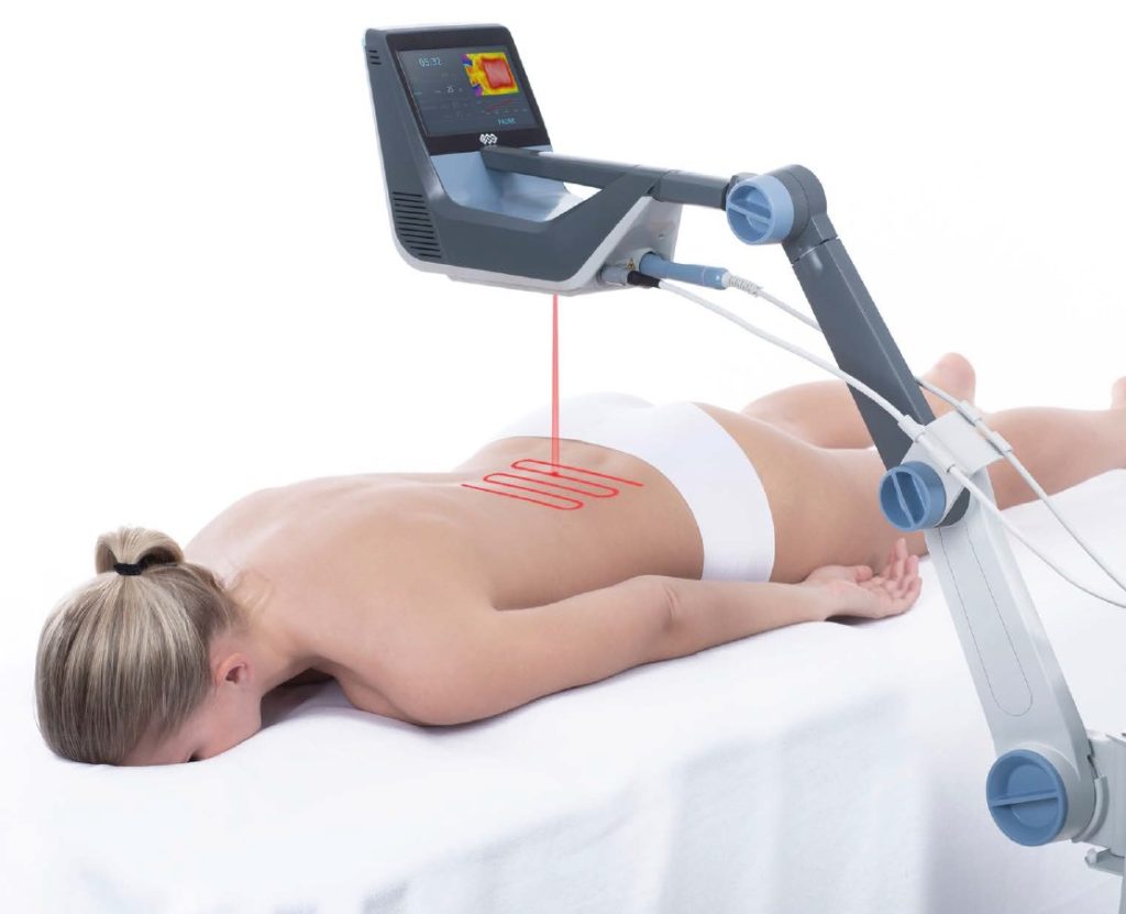 Rehaklinika High Intensity Laser